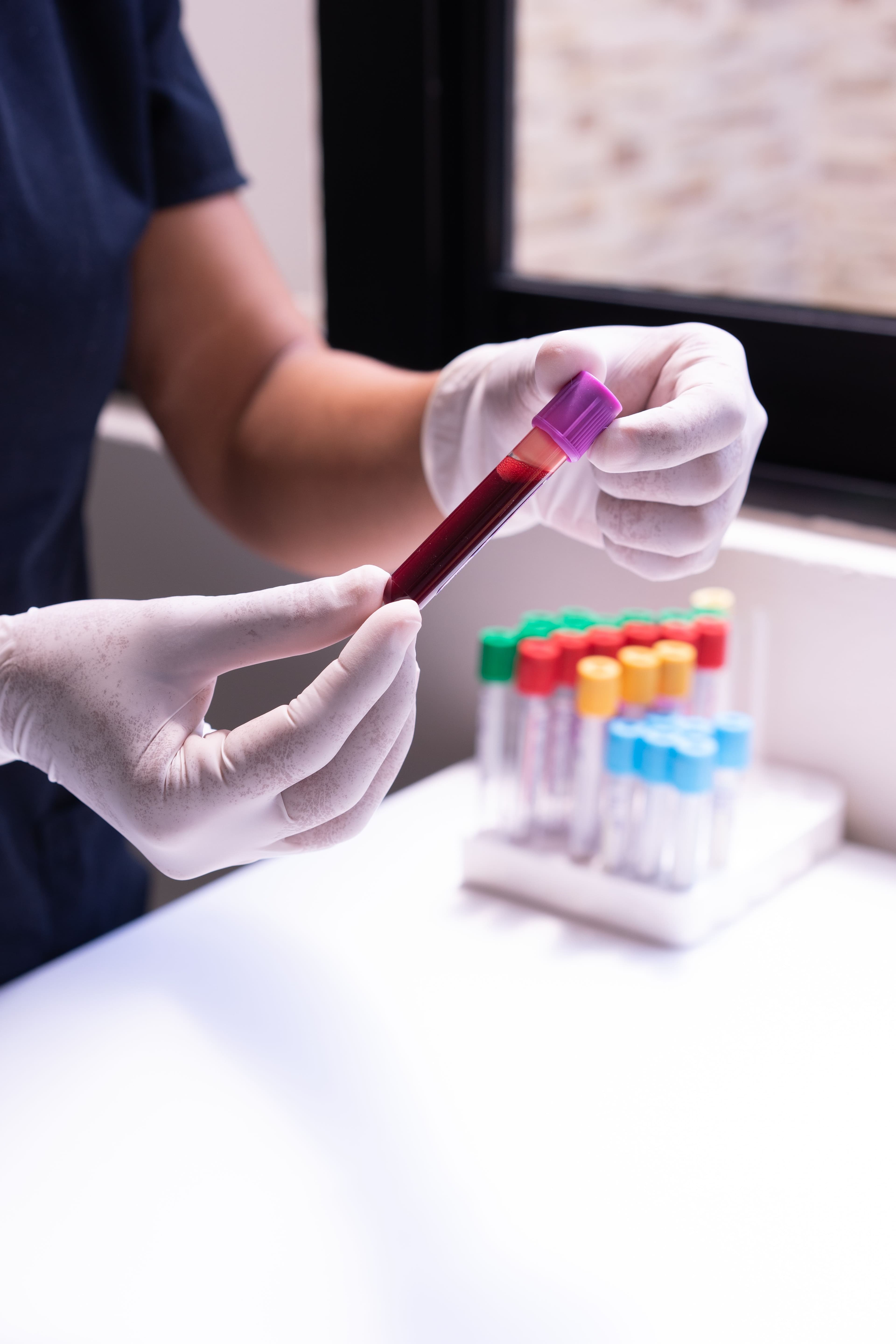 Gloved hands holding a blood sample tube beside a rack of color-capped tubes